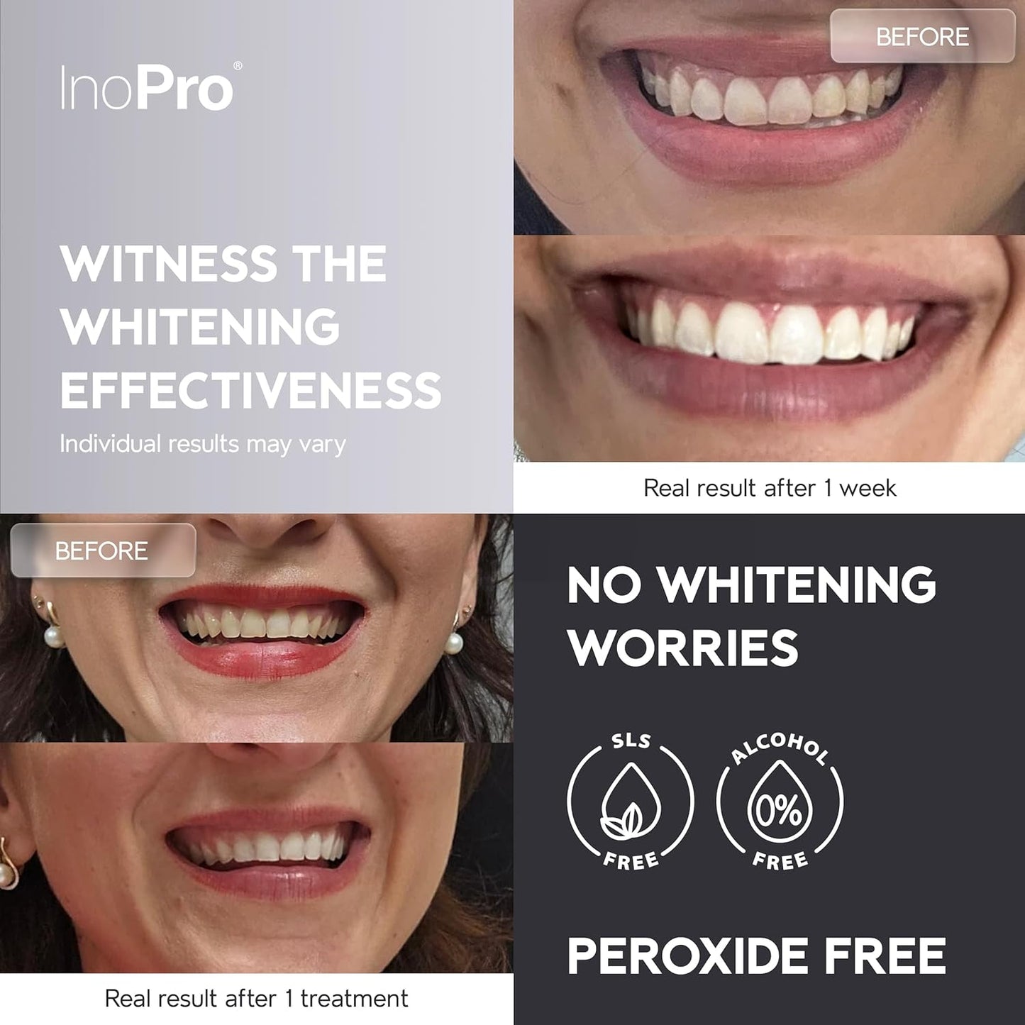 Advanced Whitening Strips (28 Strips)
