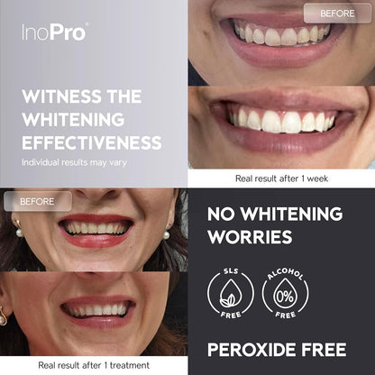 Advanced Whitening Strips (28 Strips)