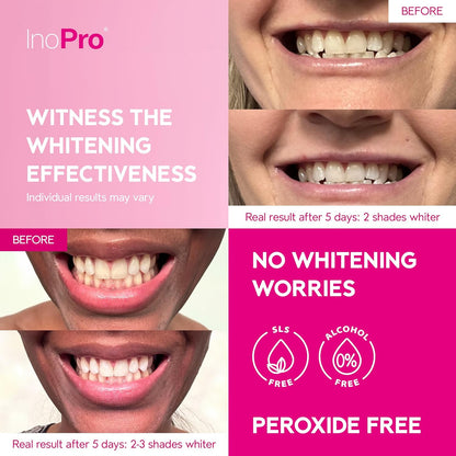 Green Whitening Strips (28 Strips)